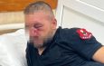 Drejtori i Përgjithshëm Skender Hita viziton punonjësit e Policisë të dëmtuar gjatë tubimit