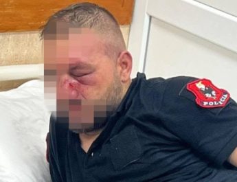 Drejtori i Përgjithshëm Skender Hita viziton punonjësit e Policisë të dëmtuar gjatë tubimit